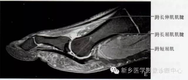 足部断层解剖+详细标注