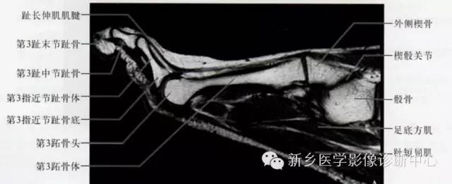 足部断层解剖+详细标注
