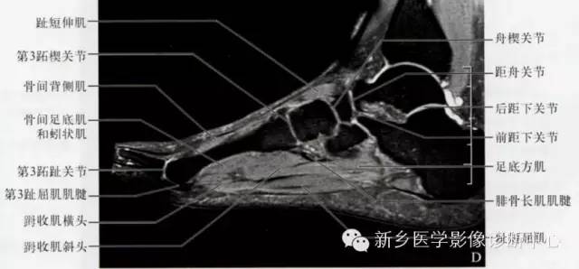 足部断层解剖+详细标注