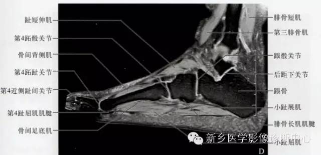 足部断层解剖+详细标注