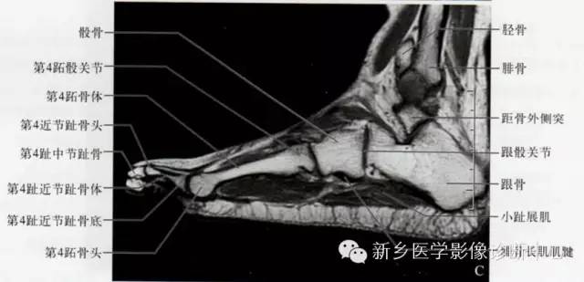 足部断层解剖+详细标注