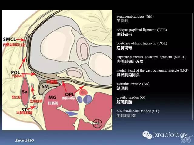 【PPT】膝关节肌腱病变的磁共振诊断