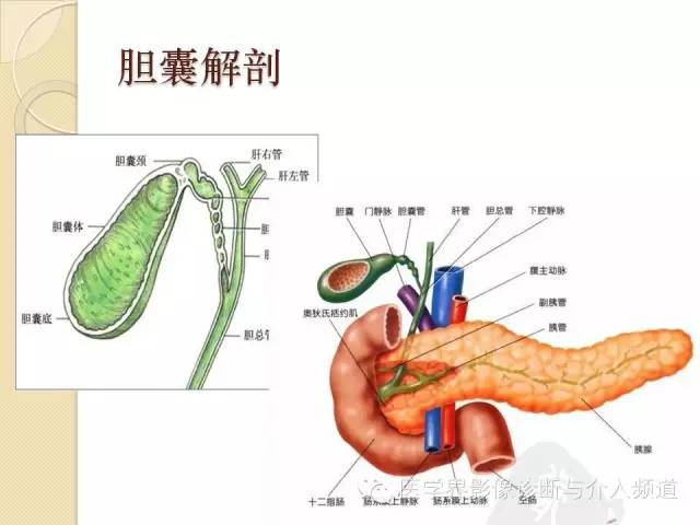 【PPT】瓷化胆囊