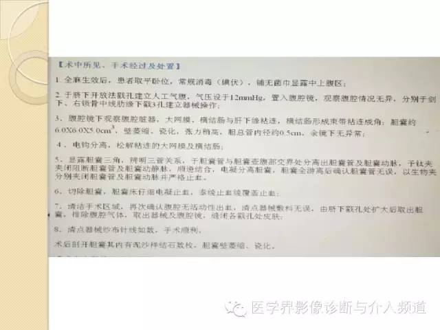 【PPT】瓷化胆囊