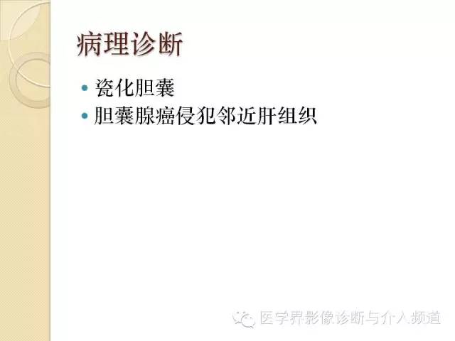 【PPT】瓷化胆囊