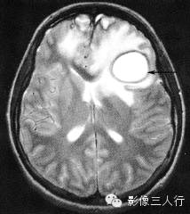 自动草稿