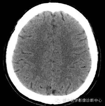 头部横断位解剖+详细标注
