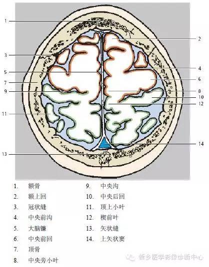 头部横断位解剖+详细标注