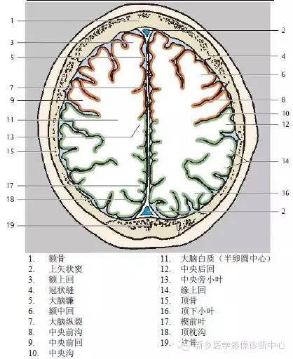 头部横断位解剖+详细标注