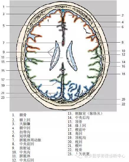 头部横断位解剖+详细标注