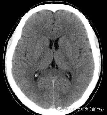 头部横断位解剖+详细标注