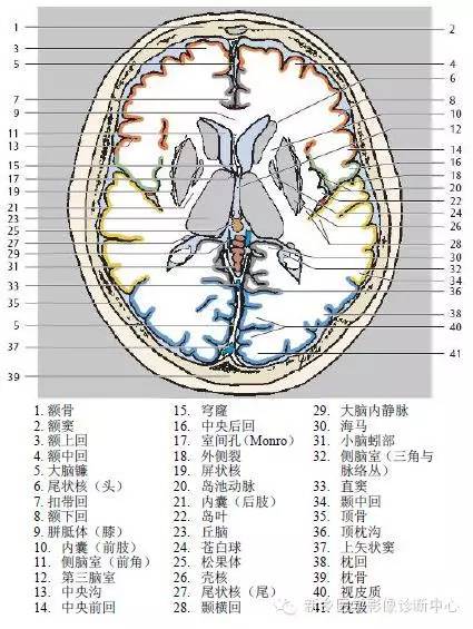 头部横断位解剖+详细标注