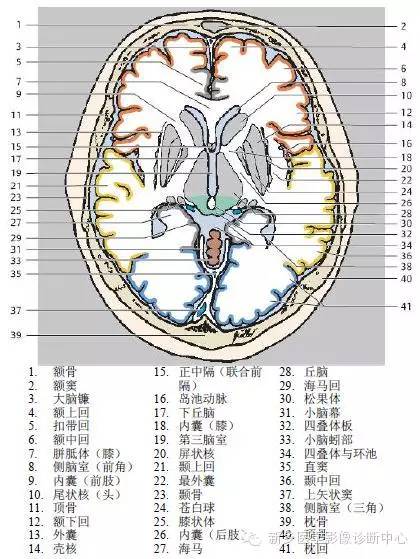 头部横断位解剖+详细标注