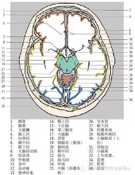头部横断位解剖+详细标注