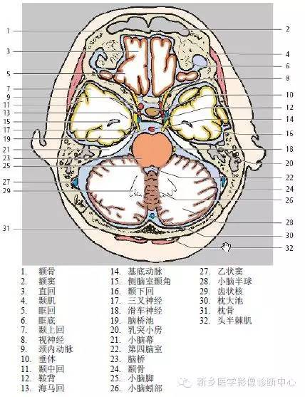 头部横断位解剖+详细标注