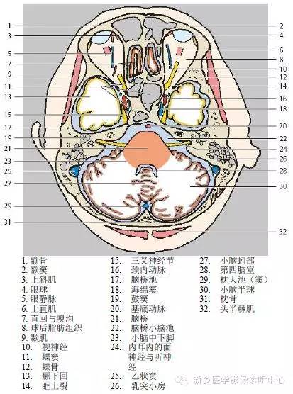 头部横断位解剖+详细标注