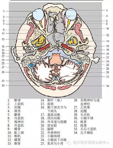 头部横断位解剖+详细标注