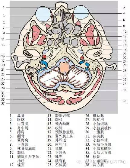 头部横断位解剖+详细标注