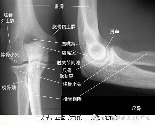 全身常见部位X线详细解剖+标注