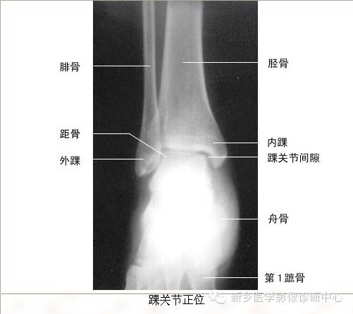 全身常见部位X线详细解剖+标注