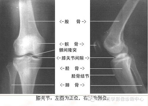 全身常见部位X线详细解剖+标注