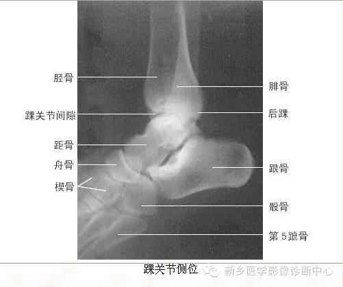 全身常见部位X线详细解剖+标注