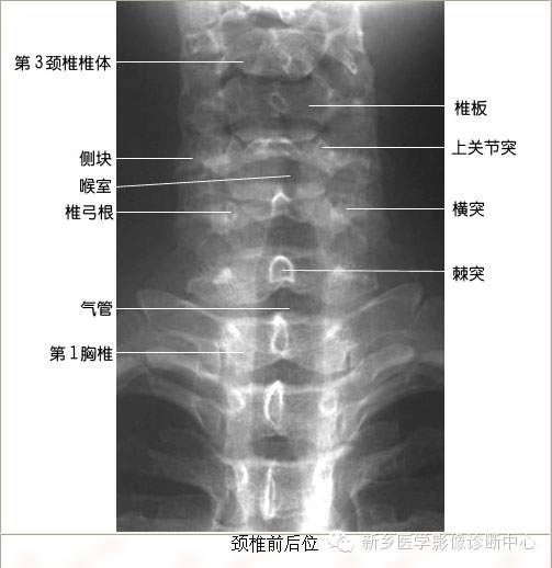 全身常见部位X线详细解剖+标注