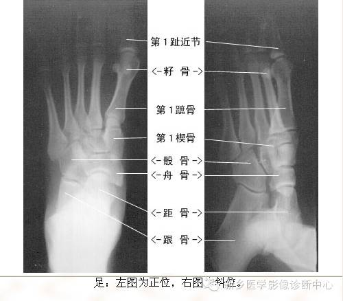 全身常见部位X线详细解剖+标注
