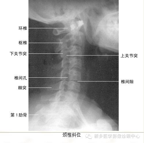 全身常见部位X线详细解剖+标注