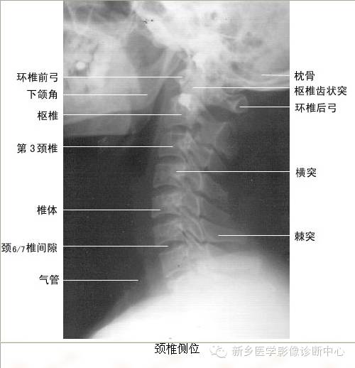全身常见部位X线详细解剖+标注