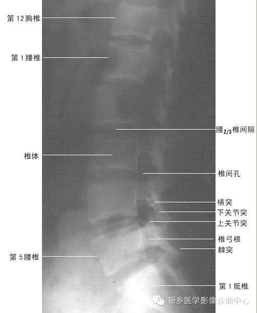 全身常见部位X线详细解剖+标注