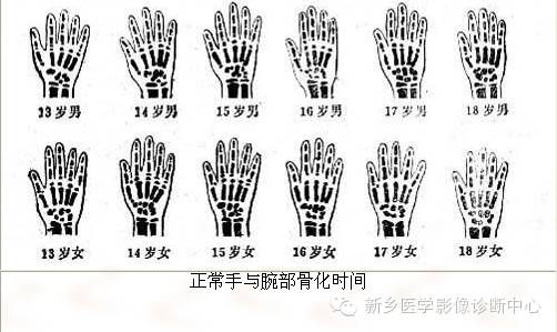 全身常见部位X线详细解剖+标注