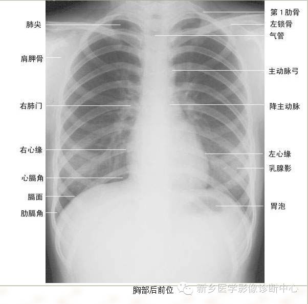 全身常见部位X线详细解剖+标注
