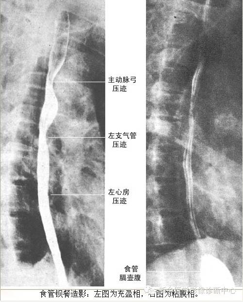 全身常见部位X线详细解剖+标注