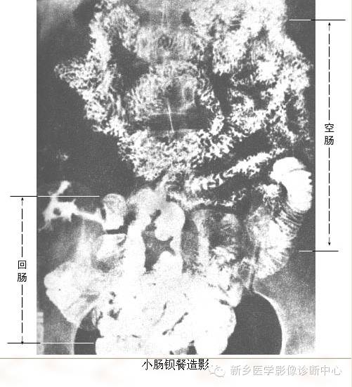 全身常见部位X线详细解剖+标注