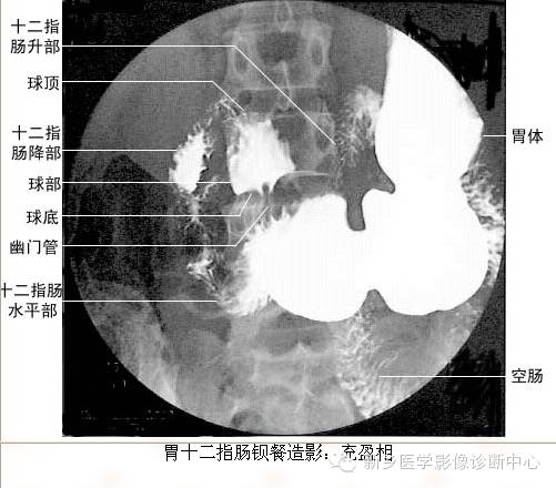 全身常见部位X线详细解剖+标注