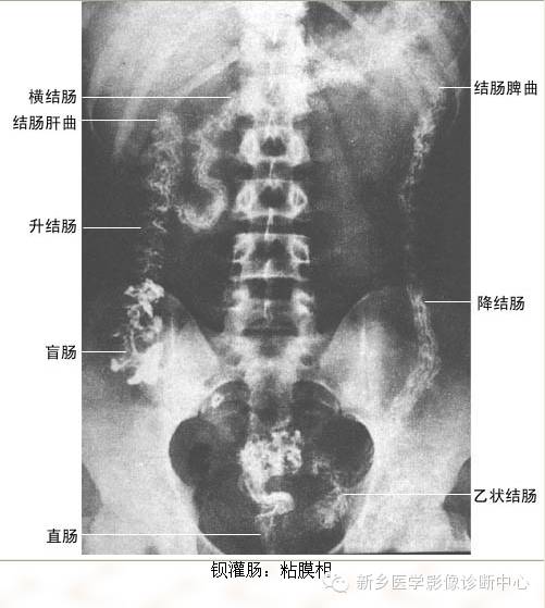 全身常见部位X线详细解剖+标注