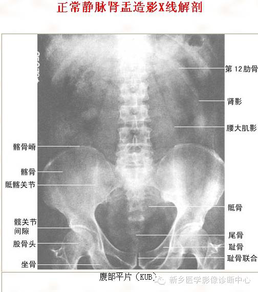 全身常见部位X线详细解剖+标注