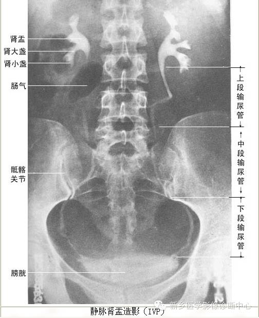 全身常见部位X线详细解剖+标注