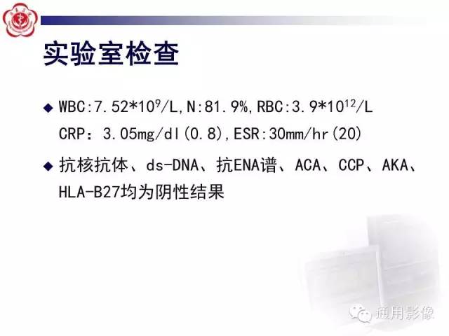 【病例】骶骨结核1例影像表现
