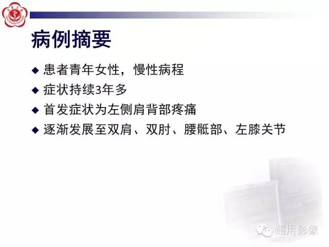 【病例】骶骨结核1例影像表现