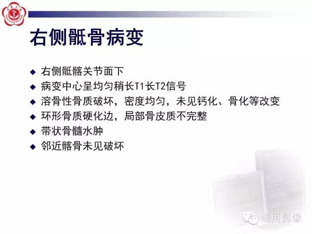 【病例】骶骨结核1例影像表现