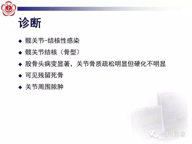 【病例】骶骨结核1例影像表现