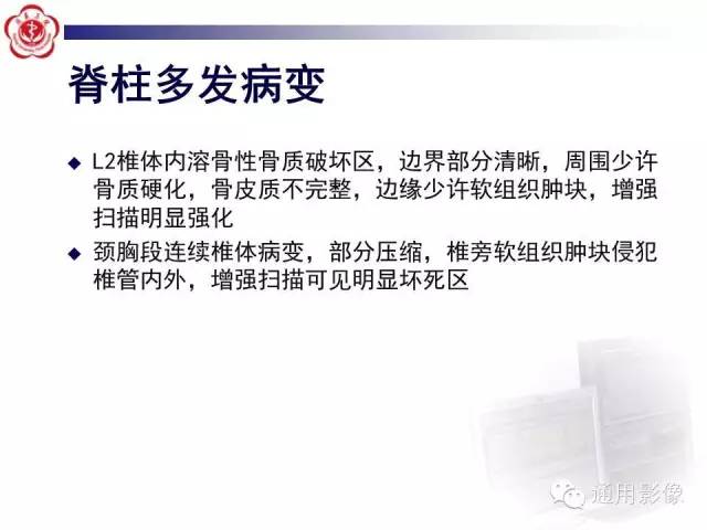 【病例】骶骨结核1例影像表现