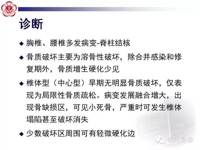 【病例】骶骨结核1例影像表现