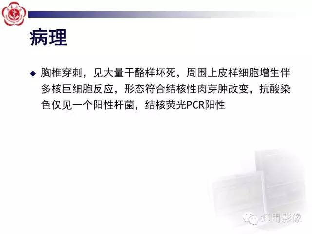 【病例】骶骨结核1例影像表现