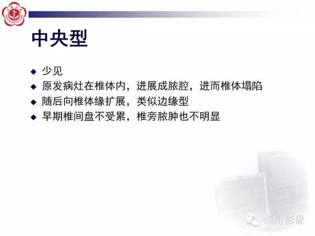 【病例】骶骨结核1例影像表现