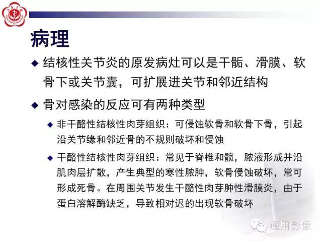 【病例】骶骨结核1例影像表现
