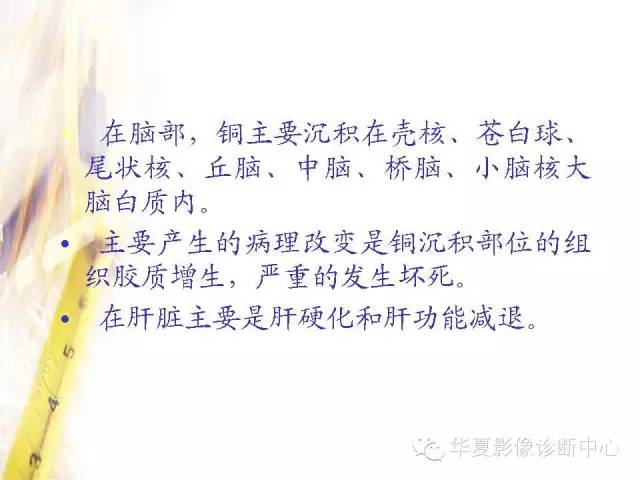 【PPT】肝豆状核变性