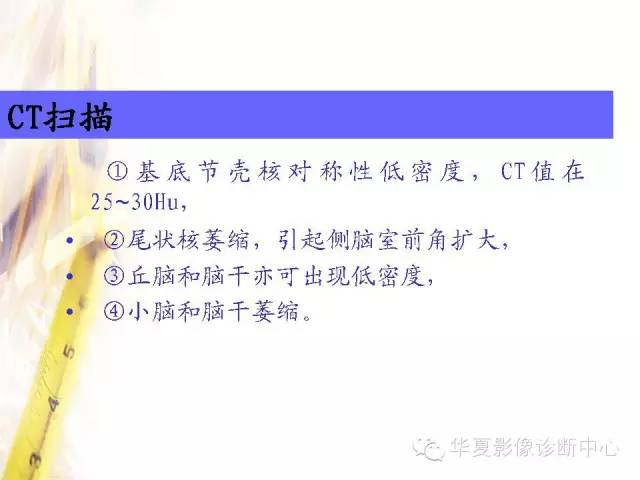 【PPT】肝豆状核变性